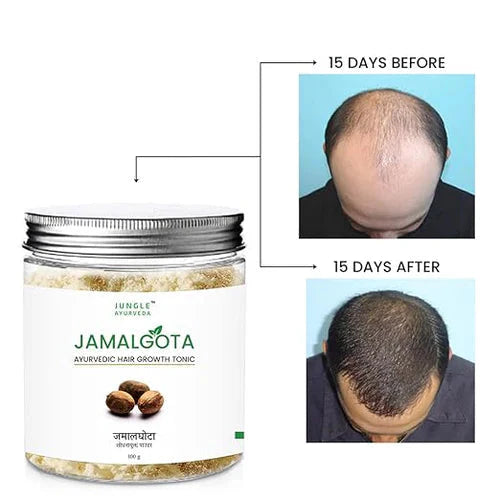 Jamalgota™ - Ayurvedic Hair Growth Powder 🌱✨ (Buy 1 Get 1 Free🔥)